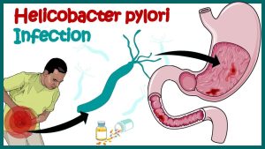 h.pylori 1
